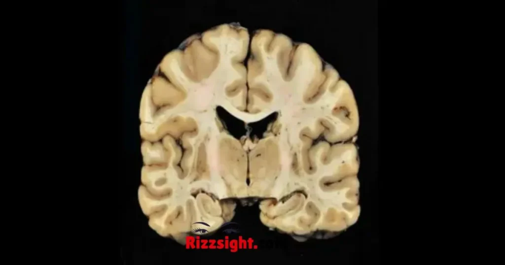 Cte Rizz Pickup Lines